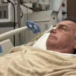 Bolsonaro apresenta melhora na função renal, mas segue internado na UTI